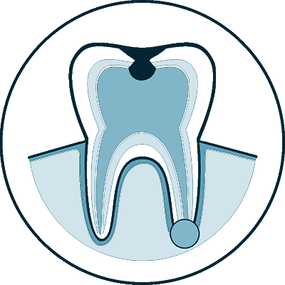 root canal icon 1 slc
