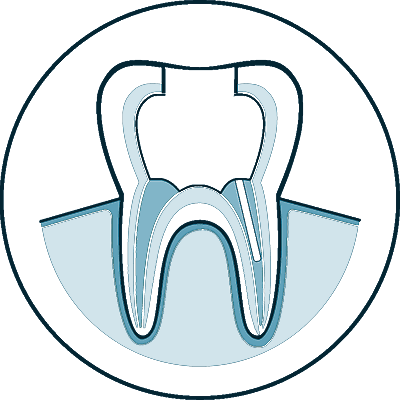 root canal icon 2 slc