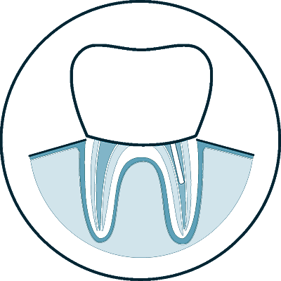 root canal icon 3 slc
