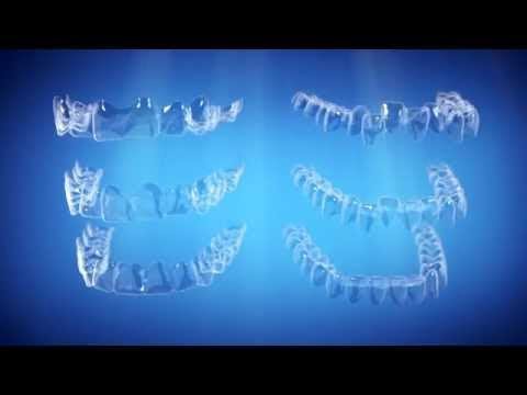 Straight Talk About Crooked Teeth | Invisalign