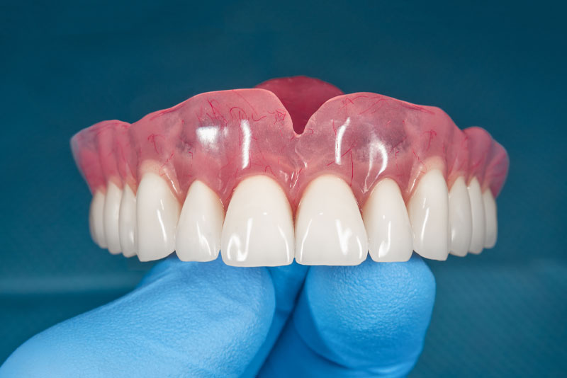 full dentures 1