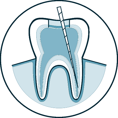root canal icon 4 slc